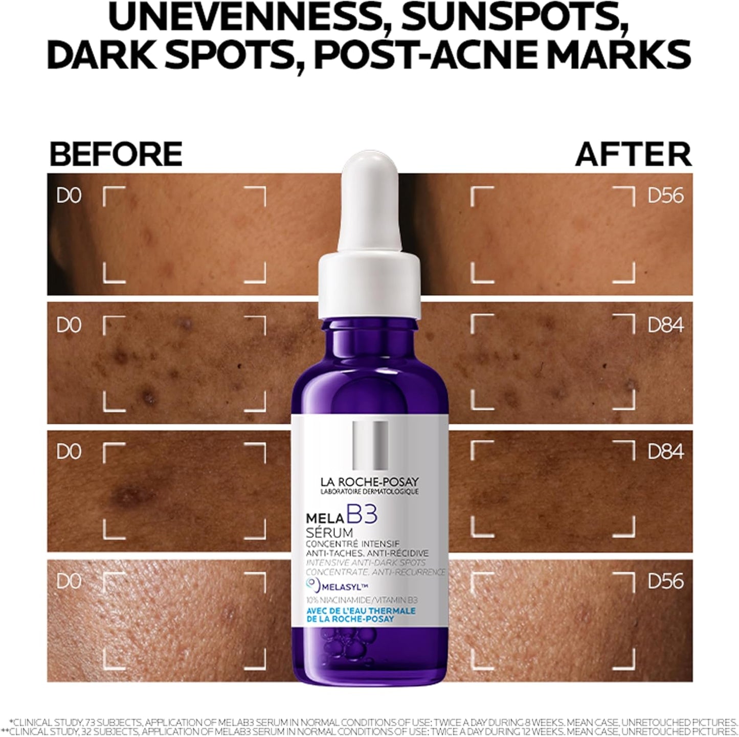 La Roche-Posay Mela B3 Dark Spot Niacinamide Serum 30ml – Anti-Hyperpigmentation Serum with 10% Niacinamide & Melasyl™